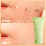 Exfoliating Gel Deep Cleansing