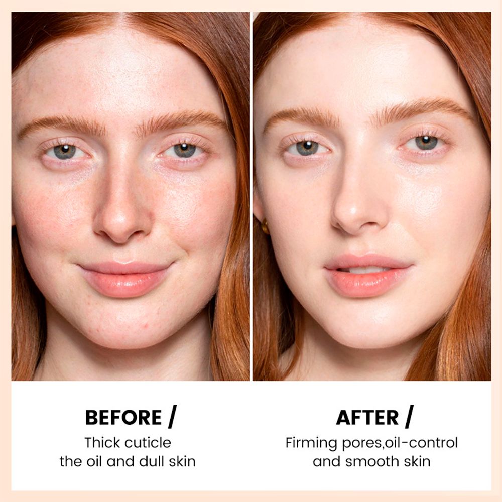 Exfoliating Gel Deep Cleansing