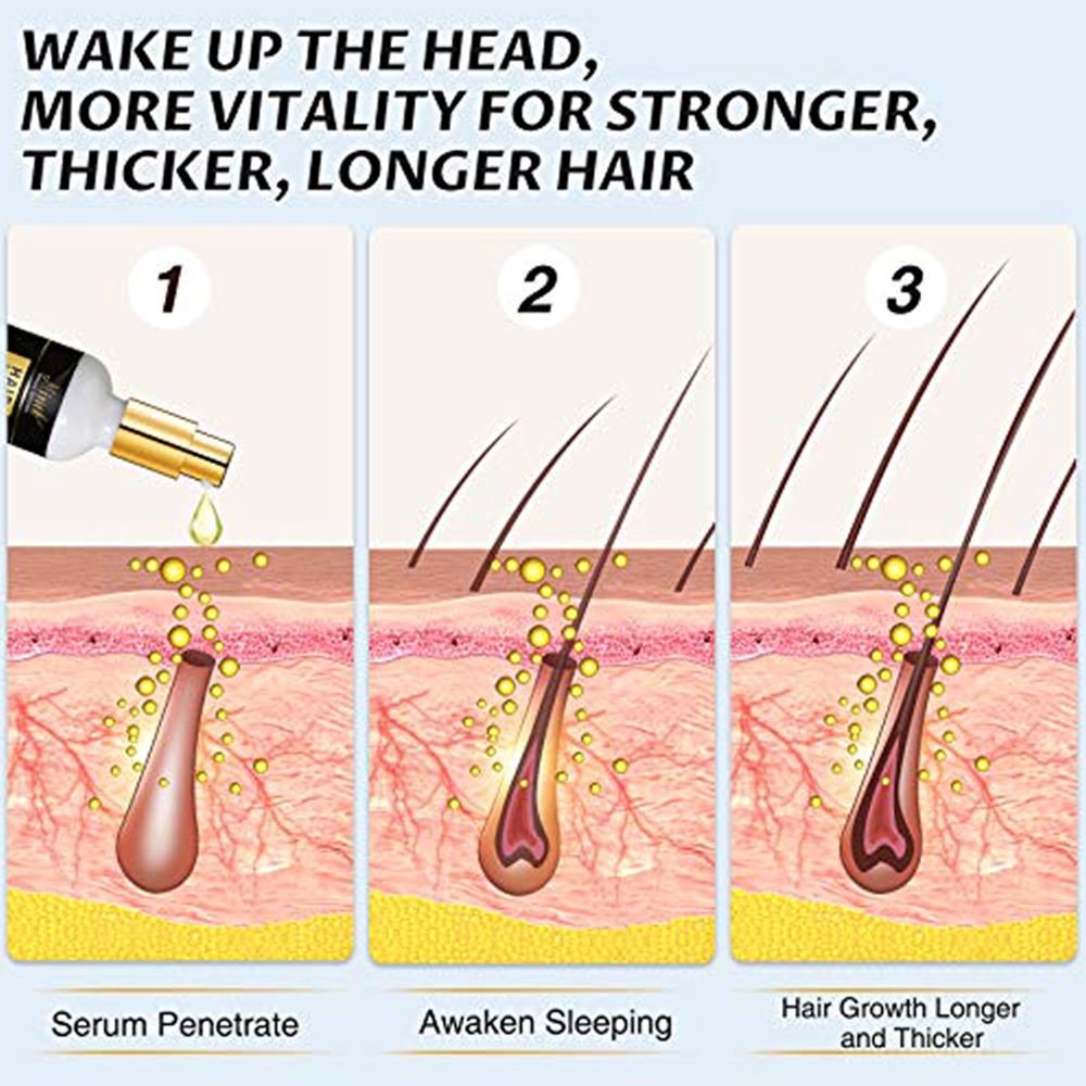 Anti-growth Biotin Oil Hair Growth Oil