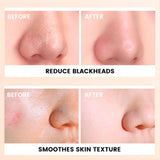Exfoliating Gel Deep Cleansing