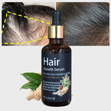 Aceite de biotina anticrecimiento Aceite para el crecimiento del cabello (10 piezas)
