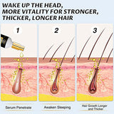 Huile de croissance des cheveux à l'huile de biotine anti-croissance (10pcs)